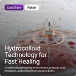 A promotional graphic for a cold sore patch showing a close-up of a transparent dome-like patch with a central metallic ring and text reading 'Cold Sore Patch' and 'Hydrocolloid Technology for Fast Healing.'.